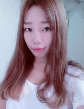 硅胶隆鼻恢复日记 硅胶隆鼻+鼻小柱延长+垫鼻尖