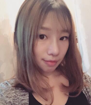 硅胶隆鼻恢复日记 硅胶隆鼻+鼻小柱延长+垫鼻尖