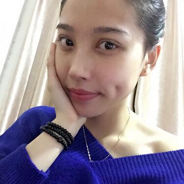 全割双眼皮恢复日记 全切双眼皮+开眼角