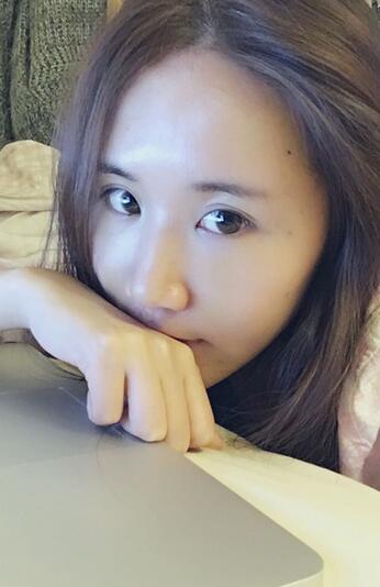 面部脂肪填充后图片 自体脂肪面部填充恢复记录