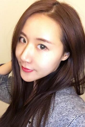 面部脂肪填充后图片 自体脂肪面部填充恢复记录