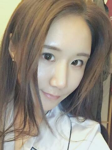 面部脂肪填充后图片 自体脂肪面部填充恢复记录