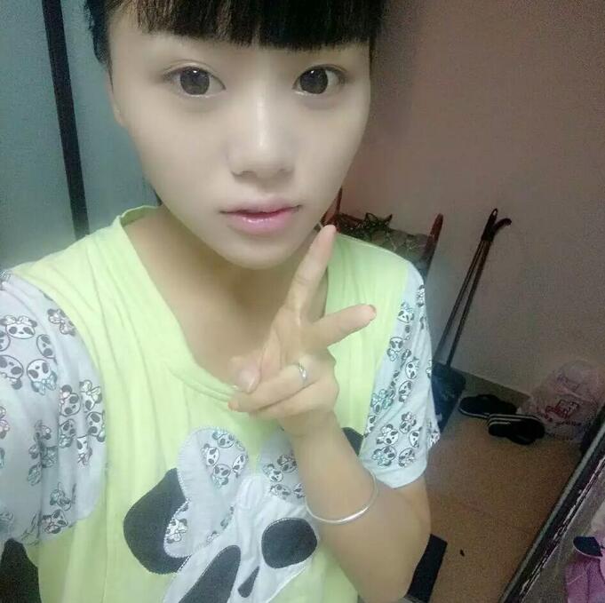 自体脂肪隆胸手术恢复全过程图片16800元做的果很好
