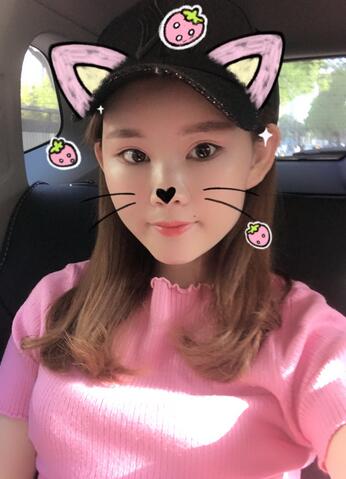 详细部脂肪填充果图 术后恢复分享