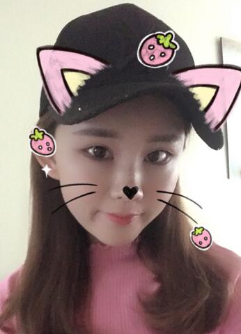 详细部脂肪填充果图 术后恢复分享