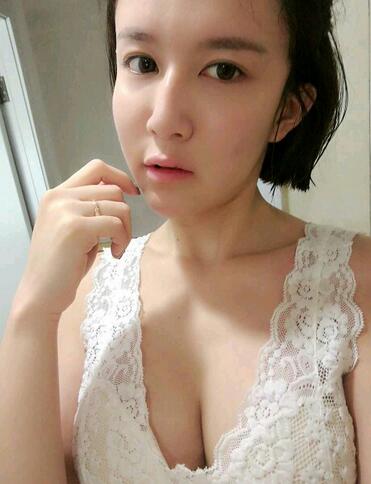 自体脂肪隆胸恢复过程分享