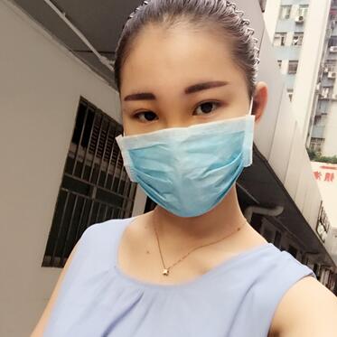 隆鼻整形手术恢复过程图 满月啦~