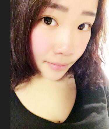 耳软骨垫鼻尖三个月图 耳软骨垫鼻尖+硅胶隆鼻