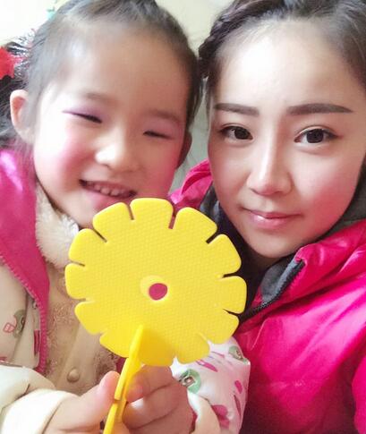 耳软骨垫鼻尖三个月图 耳软骨垫鼻尖+硅胶隆鼻