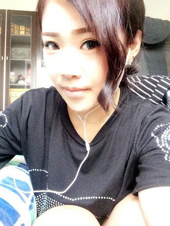 耳软骨垫鼻尖三个月图 耳软骨垫鼻尖+硅胶隆鼻