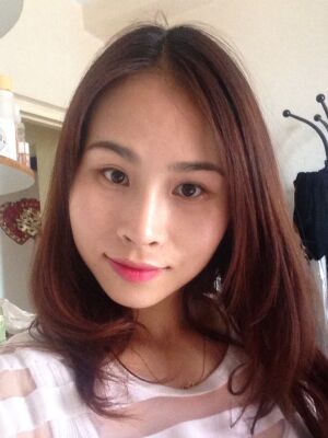 韩式微创双眼皮恢复过程图，灵动大眼轻松拥有