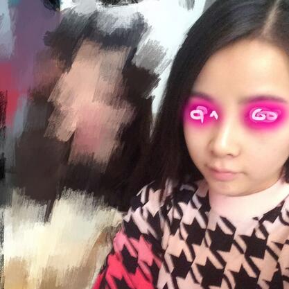 耳软骨垫鼻尖+隆鼻+鼻翼缩小3个月了