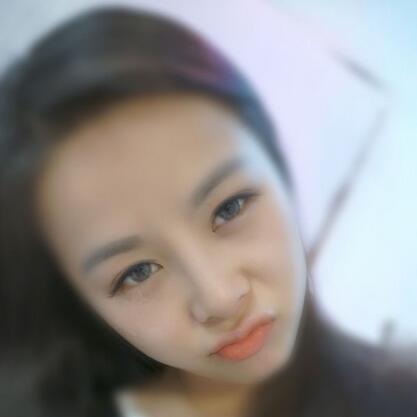 耳软骨垫鼻尖+隆鼻+鼻翼缩小3个月了