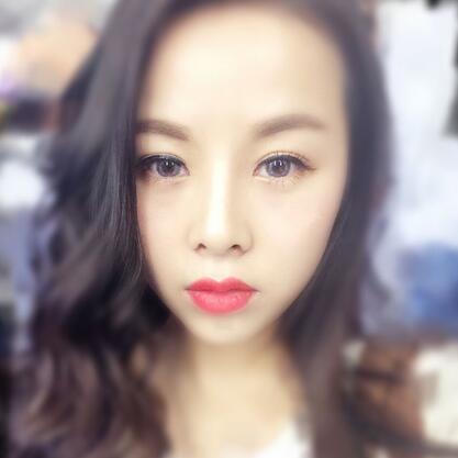 耳软骨垫鼻尖+隆鼻+鼻翼缩小3个月了