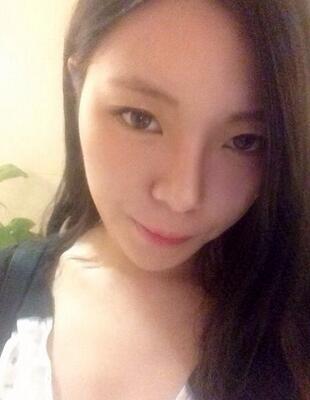 隆鼻整形真实恢复期图片 硅胶隆鼻+鼻头缩小