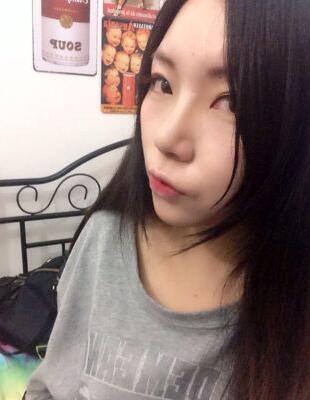 隆鼻整形真实恢复期图片 硅胶隆鼻+鼻头缩小