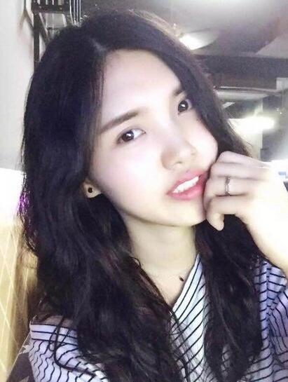 鼻子做完假体恢复图 假体隆鼻+耳软骨垫鼻尖半年了