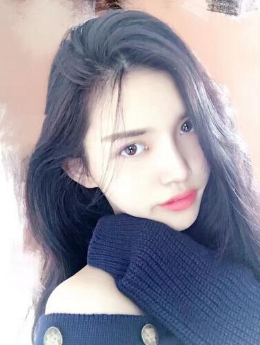 鼻子做完假体恢复图 假体隆鼻+耳软骨垫鼻尖半年了