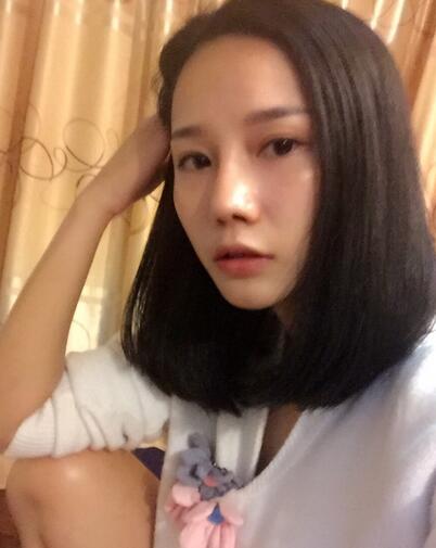 隆鼻整形真实恢经历 晒图啦！