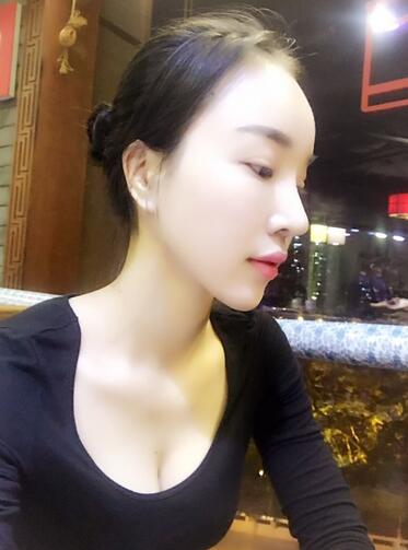 鼻修复后的恢复期经历分享