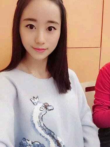 割双眼皮案例图片 双眼皮手术20天