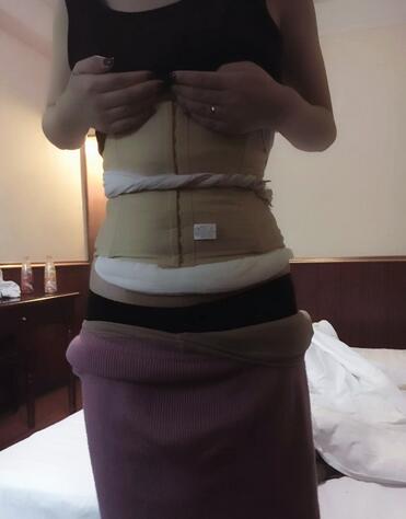 广州威利斯腰腹吸脂