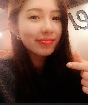 广州凯美达微创双眼皮手术恢复期纪实