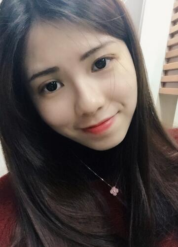 广州凯美达微创双眼皮手术恢复期纪实