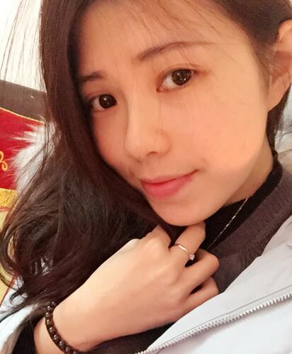 广州凯美达微创双眼皮手术恢复期纪实