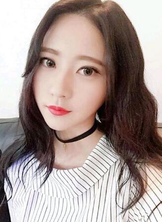上海名仁割双眼皮后一个月恢复过程图