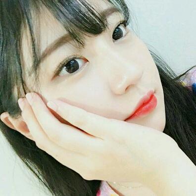 上海名仁割双眼皮后一个月恢复过程图