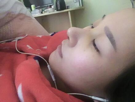 上海名仁膨体隆鼻+耳软骨垫鼻尖恢复日记