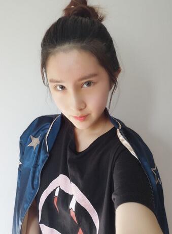 成都美未央隆鼻整形手术恢复日记图