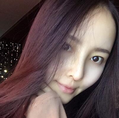 武汉爱美汇隆鼻整形恢复期图片