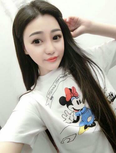 上海九院李圣利隆鼻整形真实恢复期图片