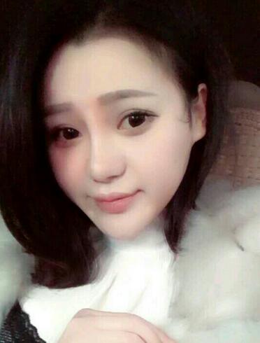 上海九院李圣利隆鼻整形真实恢复期图片