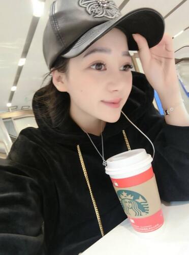 上海九院李圣利隆鼻整形真实恢复期图片