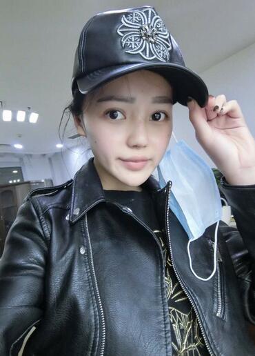 上海九院李圣利隆鼻整形真实恢复期图片