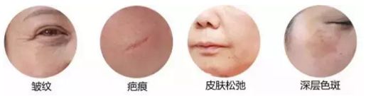 武汉医院做彩光嫩肤多少钱一次