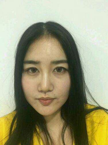 北京八大处范飞隆鼻整形案例