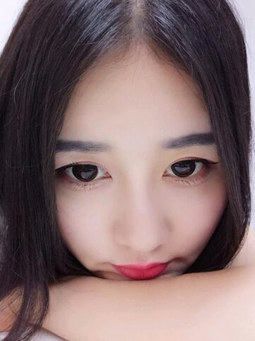 北京八大处范飞隆鼻整形案例