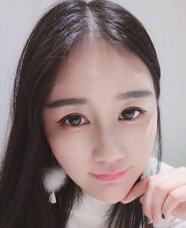 北京八大处范飞隆鼻整形案例