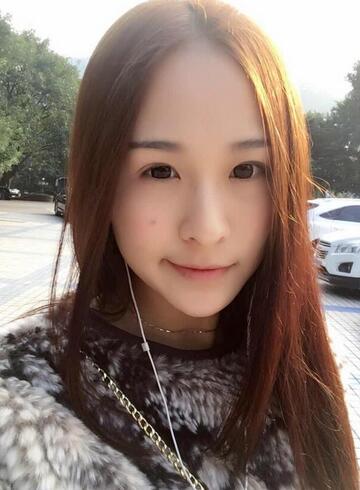 杭州大麦微针龙都整形开眼角+割双眼皮恢复记录