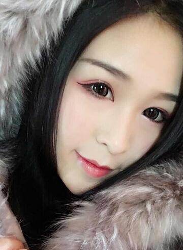 杭州大麦微针龙都整形开眼角+割双眼皮恢复记录