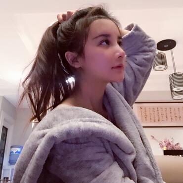 发际线调整果对比图 杭州大麦微针龙都发际线种植