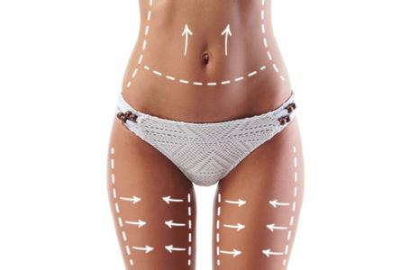 武汉做全身吸脂手术多少钱