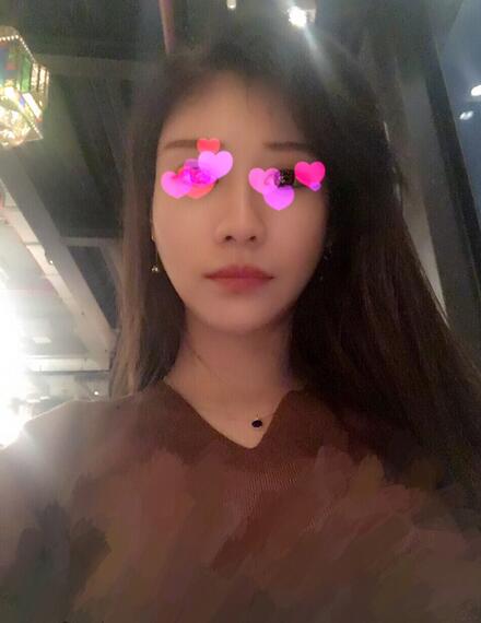 北京叶子磨下颌角整形的果图