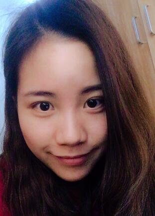 北京艺星王英勇隆鼻案例 隆鼻整形三个月