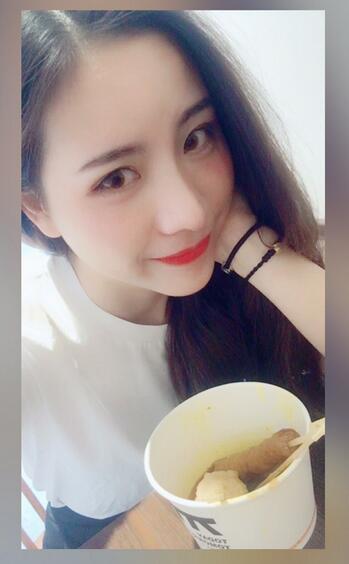 北京艺星王英勇隆鼻案例 隆鼻整形三个月