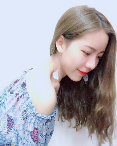 北京艺星王英勇隆鼻案例 隆鼻整形三个月